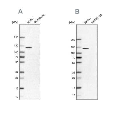 Western Blot: NLRP2/NALP2 Antibody [NBP2-58146]