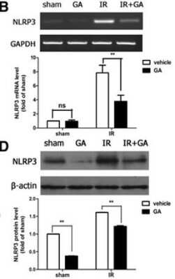 Western Blot: NLRP3/NALP3 AntibodyBSA Free [NBP1-77080]