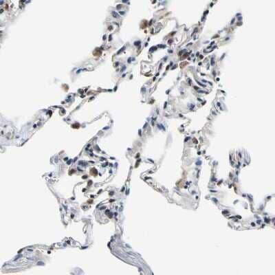 Immunohistochemistry-Paraffin: NLRP3/NALP3 Antibody [NBP1-90207]