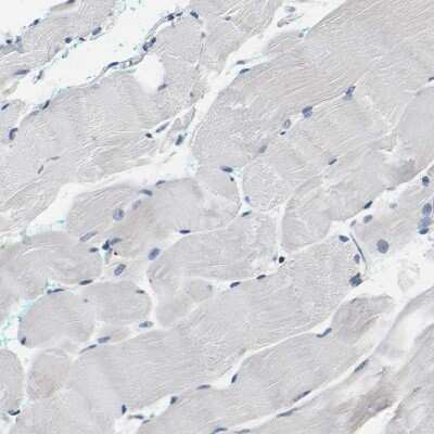 Immunohistochemistry-Paraffin: NLRP3/NALP3 Antibody [NBP1-90207]