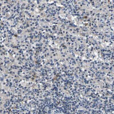 Immunohistochemistry-Paraffin: NLRP3/NALP3 Antibody [NBP1-90207]