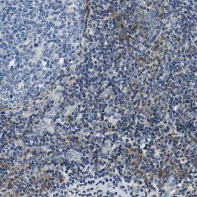 Immunohistochemistry-Paraffin: NLRP3/NALP3 Antibody [NBP1-90207]