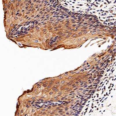 Immunohistochemical Staining of NLRP3/NALP3 in Paraffin Embedded Human Esophagus