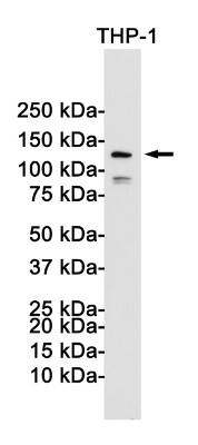 Western Blot: NLRP3/NALP3 Antibody (S07-9E9) [NBP3-20025]