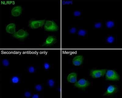 Immunocytochemistry/ Immunofluorescence: NLRP3/NALP3 Antibody (SC06-23) [NBP2-67639]