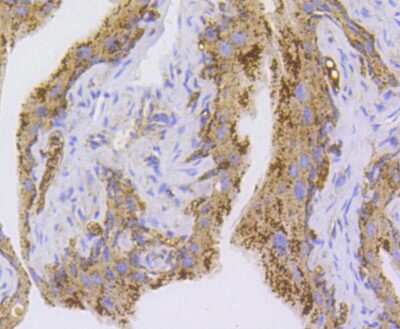 Immunohistochemistry-Paraffin: NLRP3/NALP3 Antibody (SC06-23) [NBP2-67639]