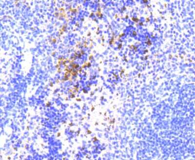 Immunohistochemistry-Paraffin: NLRP3/NALP3 Antibody (SC06-23) [NBP2-67639]