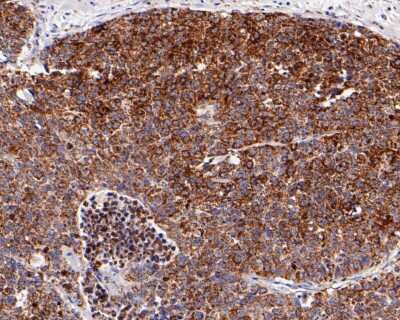 Immunohistochemistry-Paraffin: NLRP3/NALP3 Antibody (SC06-23) [NBP2-67639]