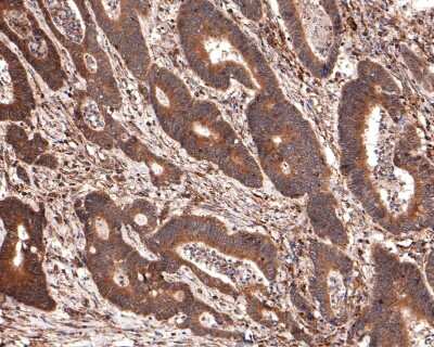 Immunohistochemistry-Paraffin: NLRP3/NALP3 Antibody (SC06-23) [NBP2-67639]
