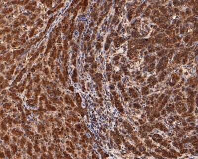Immunohistochemistry-Paraffin: NLRP3/NALP3 Antibody (SC06-23) [NBP2-67639]