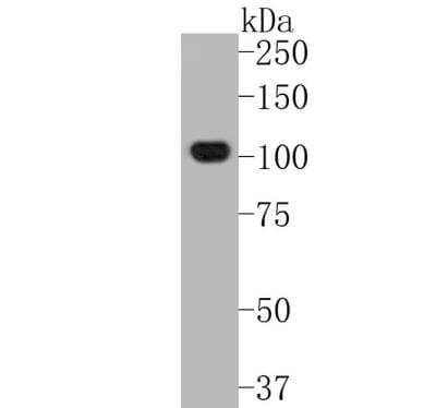 Western Blot: NLRP3/NALP3 Antibody (SC06-23) [NBP2-67639]