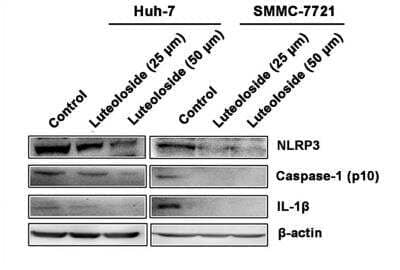 Western Blot Analysis of NLRP3/NALP3 in Luteoloside-Exposed Huh-7 and SMMC-7721 Cells