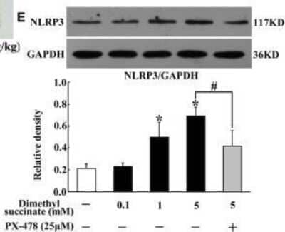 Western Blot Detection of NLRP3/NALP3 in Succinate-Stimulated Synovial Fibroblasts