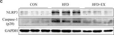Western Blot Detection of NLRP3/NALP3 in HFD Rats