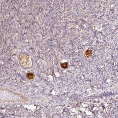 Immunohistochemistry: NLRP5 Antibody [NBP2-49219]