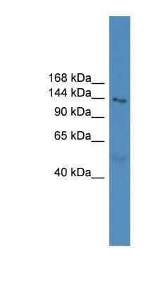 Western Blot: NLRP5 Antibody [NBP1-69159]