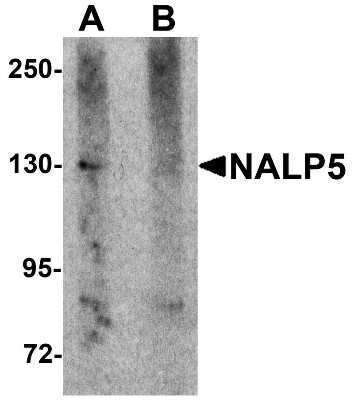 Western Blot: NLRP5 AntibodyBSA Free [NBP1-76289]