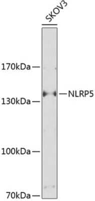 Western Blot: NLRP5 AntibodyBSA Free [NBP2-93564]