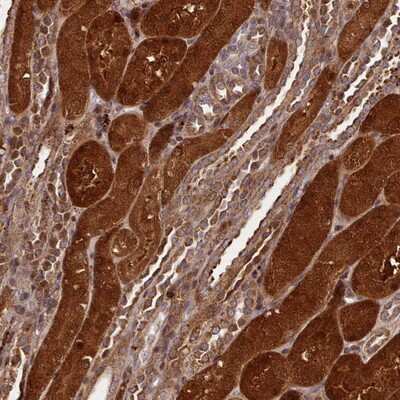 Immunohistochemistry-Paraffin: NLRP7 Antibody [NBP2-13661]