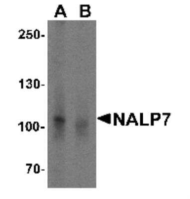 Western Blot: NLRP7 AntibodyBSA Free [NBP1-76290]