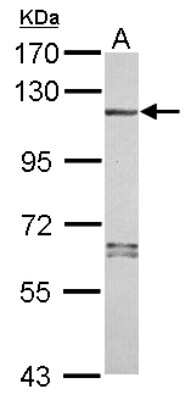 Western Blot: NLRP7 Antibody [NBP2-19548]