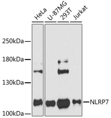 Western Blot: NLRP7 AntibodyAzide and BSA Free [NBP2-94507]