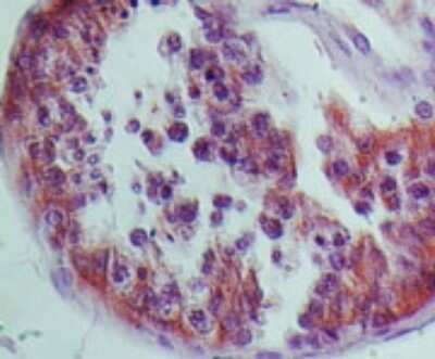 Immunohistochemistry-Paraffin: NLRP9 Antibody [NBP2-24661]