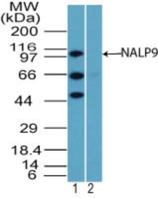 Western Blot: NLRP9 Antibody [NBP2-24661]