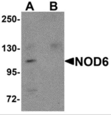 Western Blot: NLRP9 AntibodyBSA Free [NBP2-82080]