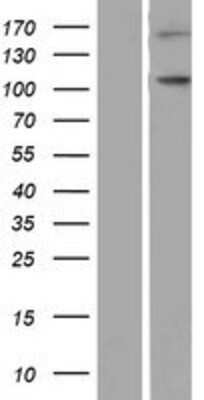 Western Blot: NLRP9 Overexpression Lysate [NBP2-05016]