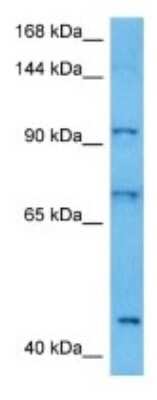 Western Blot: NLRP9A Antibody [NBP3-10227]