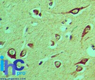 Immunohistochemistry-Paraffin: NLRX1 Antibody [NBP2-27198]
