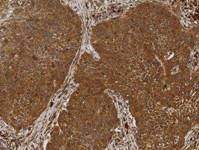 Immunohistochemistry-Paraffin: NM23-H1 Antibody (084) [NBP2-89930]