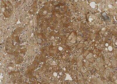 Immunohistochemistry-Paraffin: NM23-H1 Antibody (084) [NBP2-89930]