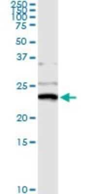 Immunoprecipitation: NM23-H1 Antibody (1D7) [H00004830-M02]