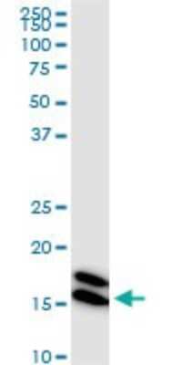 Western Blot: NM23-H1 Antibody (1D7) [H00004830-M02]