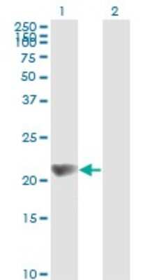 Western Blot: NM23-H1 Antibody (1D7) [H00004830-M02]