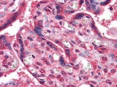 Immunohistochemistry-Paraffin: NM23-H1 Antibody (4B2) - BSA Free [NBP1-47398]