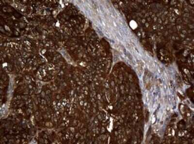 Immunohistochemistry: NM23-H1 Antibody (OTI4H2) [NBP2-46186]