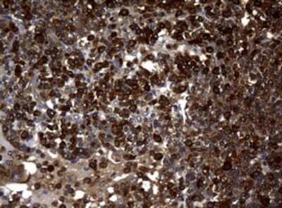 Immunohistochemistry: NM23-H1 Antibody (OTI4H2) [NBP2-46186]