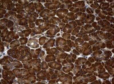 Immunohistochemistry: NM23-H1 Antibody (OTI4H2) [NBP2-46186]