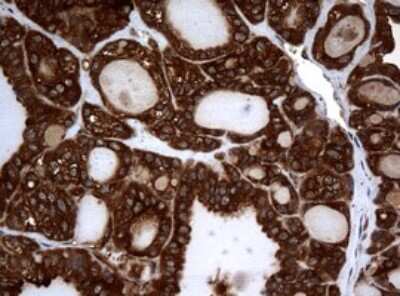 Immunohistochemistry: NM23-H1 Antibody (OTI4H2) [NBP2-46186]
