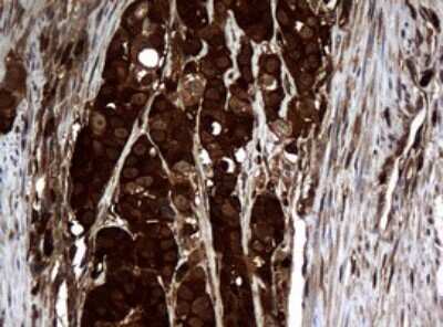 Immunohistochemistry: NM23-H1 Antibody (OTI4H2) [NBP2-46186]
