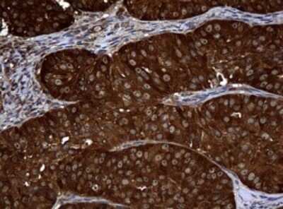 Immunohistochemistry: NM23-H1 Antibody (OTI4H2) [NBP2-46186]