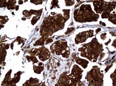 Immunohistochemistry: NM23-H1 Antibody (OTI4H2) [NBP2-46186]