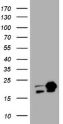 Western Blot: NM23-H1 Antibody (OTI4H2) [NBP2-46186]