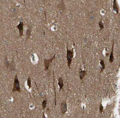 Immunohistochemistry-Paraffin: NM23-H1 Antibody [NBP1-80992]