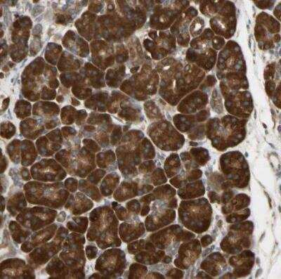 Immunohistochemistry-Paraffin: NM23-H1 Antibody [NBP1-80992]