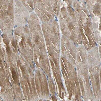 Immunohistochemistry-Paraffin: NM23-H1 Antibody [NBP1-80992]