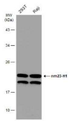 Western Blot: NM23-H1 Antibody [NBP1-30884]